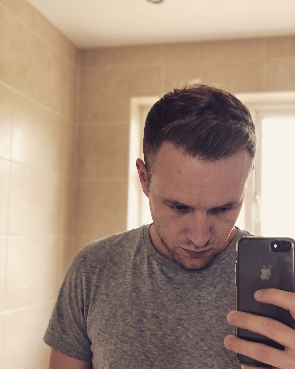 Daniel K. · Hairline