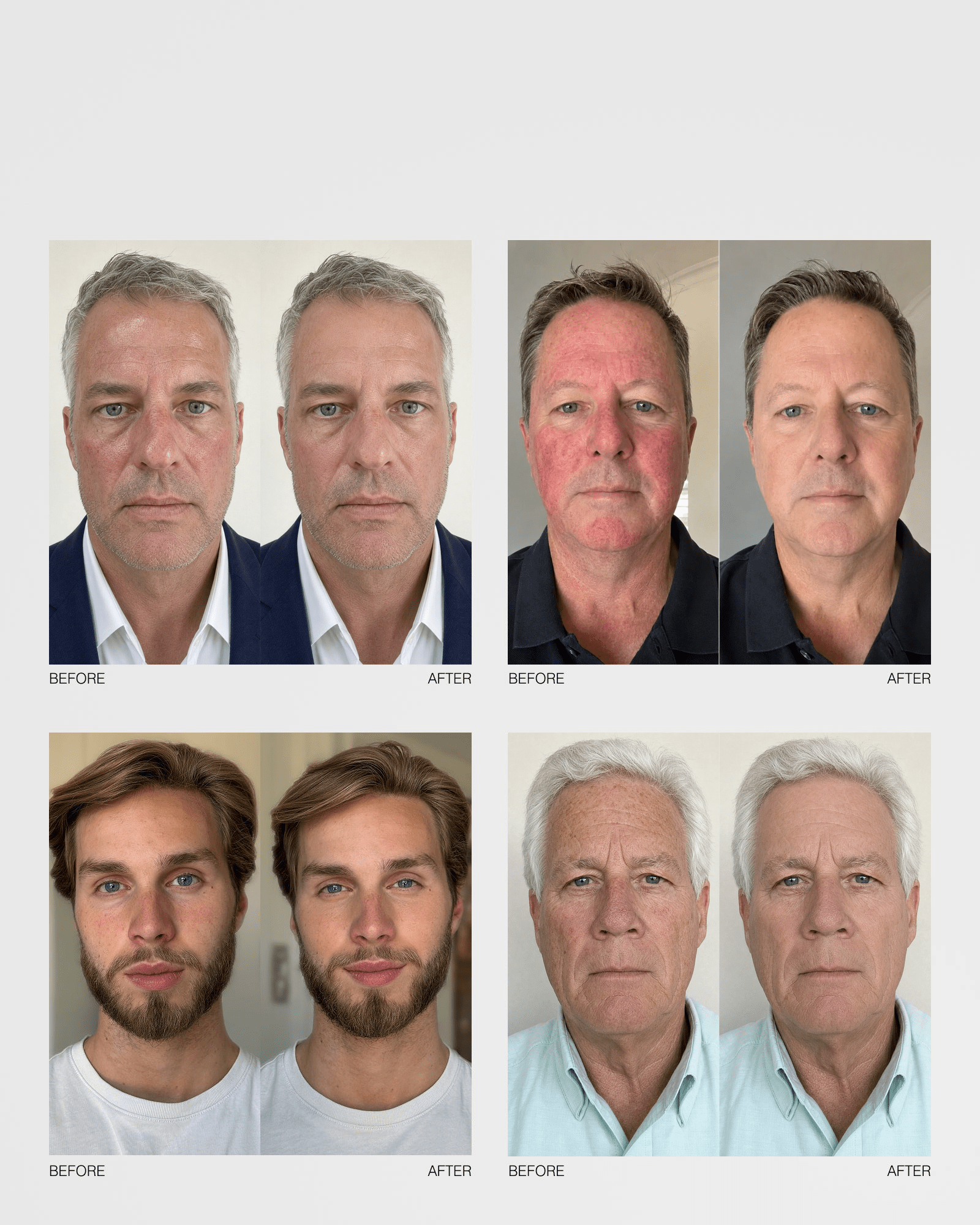 CONCEALING CREAM+ - Klyr men