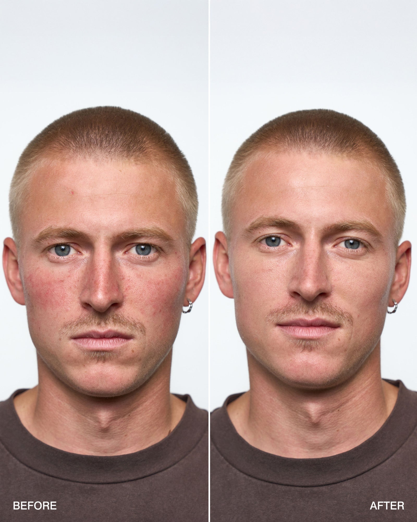 CONCEALING CREAM+ - Klyr men