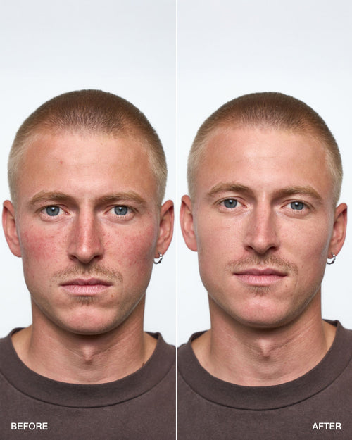 CONCEALING CREAM+ - Klyr men