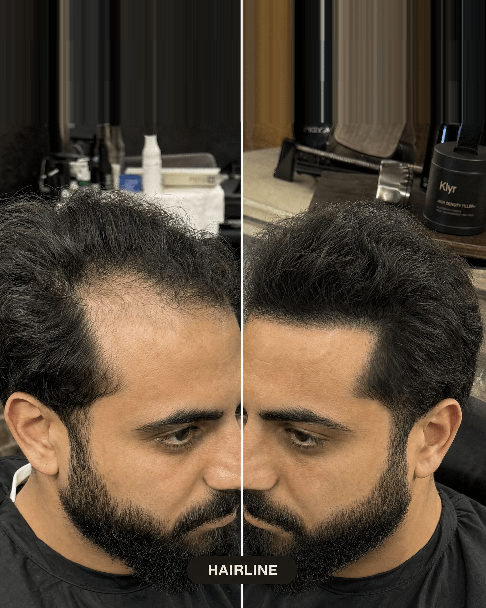 HAIR DENSITY FILLER - Klyr men