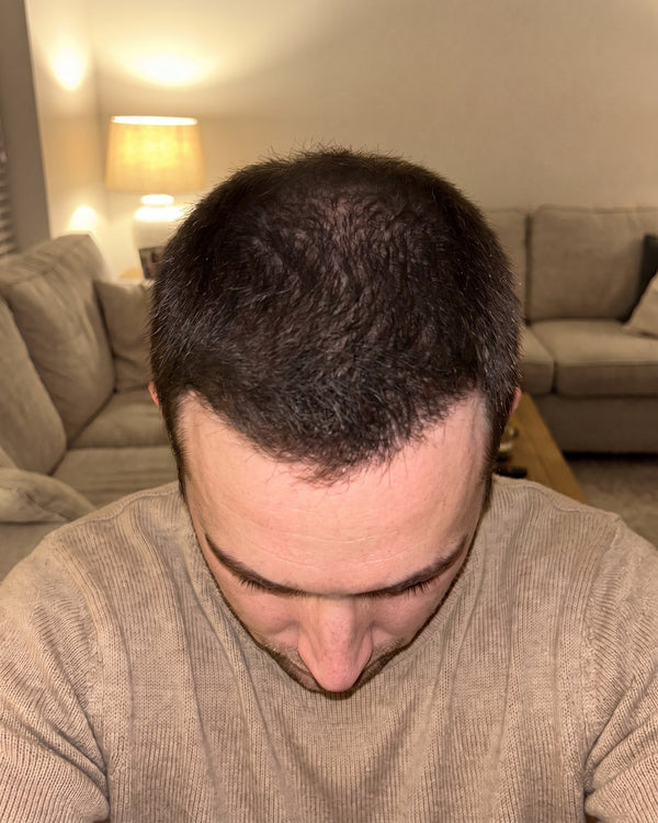 After